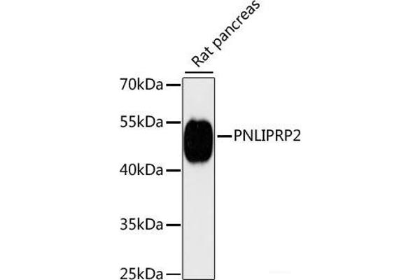 PNLIPRP2 antibody