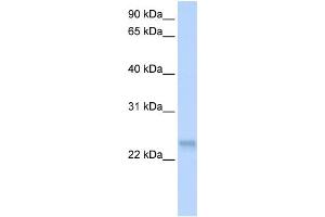 WB Suggested Anti-SFRS3 Antibody Titration: 0. (SRSF3 antibody  (N-Term))