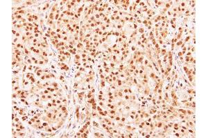 IHC-P Image Immunohistochemical analysis of paraffin-embedded A549 xenograft, using RG9MTD3, antibody at 1:500 dilution. (RG9MTD3 antibody  (Center))