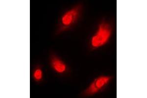 Immunofluorescent analysis of NAA15 staining in THP1 cells.
