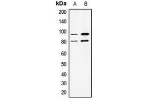 Western blot analysis of STAT1 expression in Jurkat (A), A431 (B) whole cell lysates. (STAT1 antibody  (Center))