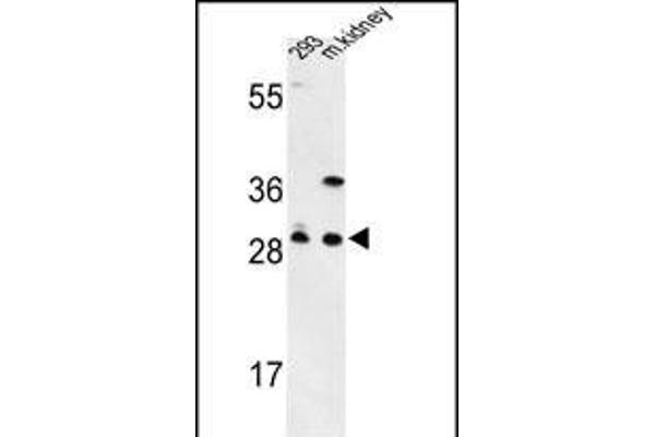 GCLM antibody  (C-Term)