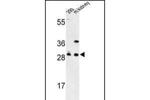 Western blot analysis of GCLM Antibody (C-term) (ABIN653046 and ABIN2842657) in 293 cell line and mouse kidney tissue lysates (35 μg/lane). (GCLM antibody  (C-Term))