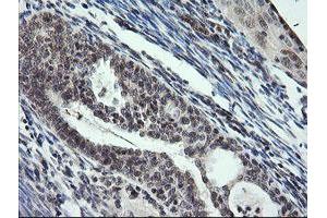 Image no. 1 for anti-Kinesin Family Member 25 (KIF25) antibody (ABIN1499039) (KIF25 antibody)