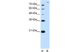 WB Suggested Antibody Titration:  2. (SLC26A5 antibody  (Middle Region))