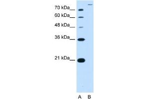 WB Suggested Antibody Titration:  2. (SLC26A5 antibody  (Middle Region))