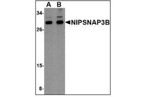 Western blot analysis of NIPSNAP3B in mouse brain tissue lysate with NIPSNAP3B antibody at (A) 1 and (B) 2 µg/ml