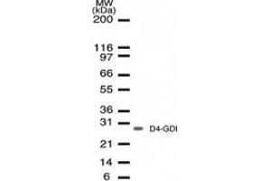 Image no. 1 for anti-rho GDP Dissociation Inhibitor (GDI) beta (ARHGDIB) (AA 125-137) antibody (ABIN207933) (ARHGDIB antibody  (AA 125-137))