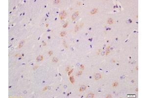 Formalin-fixed and paraffin embedded rat brain labeled with Anti-MST4 + MST3 + STK25 (Thr178 + Thr190 + Thr174) Polyclonal Antibody, Unconjugated  at 1:200 followed by conjugation to the secondary antibody and DAB staining (Mst4 / Mst3 / STK25 (pThr174), (pThr178), (pThr190) antibody)