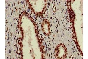 Immunohistochemistry (IHC) image for anti-X-Ray Repair Complementing Defective Repair in Chinese Hamster Cells 6 (XRCC6) (AA 2-609) antibody (ABIN7175905)