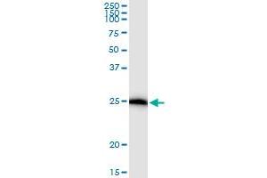 Immunoprecipitation of IL17D transfected lysate using anti-IL17D MaxPab rabbit polyclonal antibody and Protein A Magnetic Bead , and immunoblotted with IL17D MaxPab mouse polyclonal antibody (B01) . (IL17D antibody  (AA 1-202))