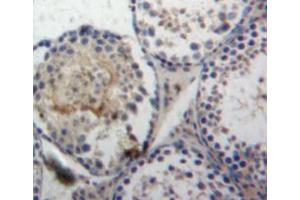 IHC-P analysis of testis tissue, with DAB staining. (LGALS8 antibody  (AA 1-316))