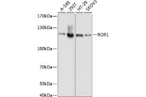 Western blot analysis of extracts of various cell lines, using ROR1 antibody (ABIN1682562, ABIN3017682, ABIN3017683 and ABIN6220210) at 1:1000 dilution. (ROR1 antibody  (AA 30-200))