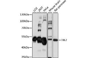 Western blot analysis of extracts of various cell lines, using TBL2 antibody (ABIN7270902) at 1:1000 dilution. (TBL2 antibody  (AA 100-430))
