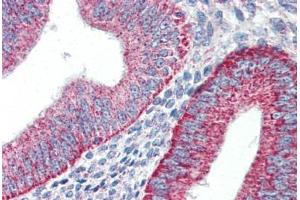 Human Uterus (formalin-fixed, paraffin-embedded) stained with HAVCR1 antibody ABIN337189 at 5 ug/ml followed by biotinylated goat anti-rabbit IgG secondary antibody ABIN481713, alkaline phosphatase-streptavidin and chromogen. (HAVCR1 antibody  (Internal Region))