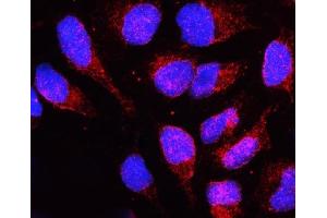 IF analysis of LBR using anti-LBR antibody (ABIN6719340).