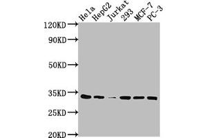 Western Blot Positive WB detected in: Hela whole cell lysate, HepG2 whole cell lysate, Jurkat whole cell lysate, 293 whole cell lysate, MCF-7 whole cell lysate, PC-3 whole cell lysate All lanes: CDK4 antibody at 1:2000 Secondary Goat polyclonal to rabbit IgG at 1/50000 dilution Predicted band size: 34, 21 kDa Observed band size: 34 kDa (Recombinant CDK4 antibody)