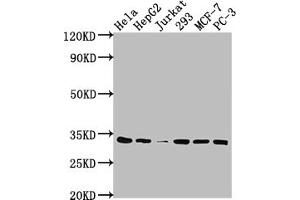 Western Blot Positive WB detected in: Hela whole cell lysate, HepG2 whole cell lysate, Jurkat whole cell lysate, 293 whole cell lysate, MCF-7 whole cell lysate, PC-3 whole cell lysate All lanes: CDK4 antibody at 1:2000 Secondary Goat polyclonal to rabbit IgG at 1/50000 dilution Predicted band size: 34, 21 kDa Observed band size: 34 kDa (Recombinant CDK4 antibody)