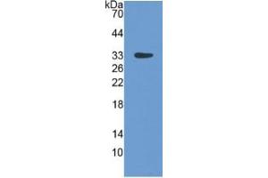 WB of Protein Standard: different control antibodies against Highly purified E. (LBP ELISA Kit)