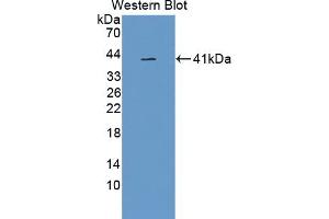 Detection of Recombinant GPLD1, Human using Polyclonal Antibody to Glycosylphosphatidylinositol Specific Phospholipase D1 (GPLD1) (GPLD1 antibody  (AA 496-840))