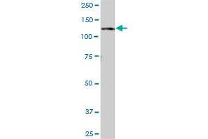 RNF20 MaxPab polyclonal antibody. (RNF20 antibody  (AA 1-975))
