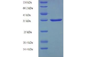 SDS-PAGE (SDS) image for AlkB, Alkylation Repair Homolog 3 (ALKBH3) (AA 1-170) protein (His-SUMO Tag) (ABIN5711658)