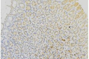 ABIN6273618 at 1/100 staining Human gastric tissue by IHC-P.