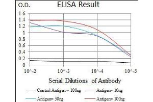 Black line: Control Antigen (100 ng), Purple line: Antigen(10 ng), Blue line: Antigen (50 ng), Red line: Antigen (100 ng), (Calmegin antibody  (AA 249-405))
