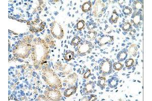 Image no. 1 for anti-RNA Binding Motif Protein 46 (RBM46) (AA 121-170) antibody (ABIN6736259) (RBM46 antibody  (AA 121-170))