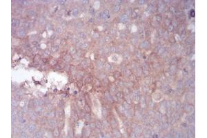 Immunohistochemistry (IHC) image for anti-Zinc Finger Protein GLI1 (GLI1) (AA 284-449) antibody (ABIN5542320)