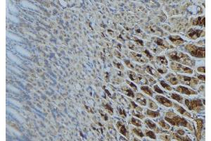 ABIN6277302 at 1/100 staining Human gastric tissue by IHC-P. (SDHA antibody  (Internal Region))