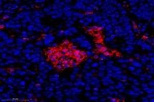 Immunofluorescent analysis of paraformaldehyde-fixed human ovay cancer using FLJ22167 (ABIN7073961) at dilution of 1: 1400 (FLJ22167 antibody)