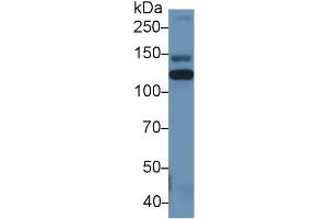 Western Blotting (WB) image for anti-Inter alpha Globulin Inhibitor H4 (ITIH4) (AA 273-424) antibody (ABIN7438340)