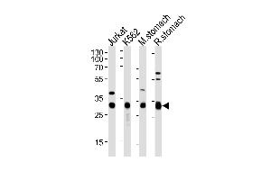 Western blot analysis of lysates from Jurkat, K562 cell line, mouse stomach and rat stomach tissue (from left to right), using ESD Antibody at 1:1000 at each lane.