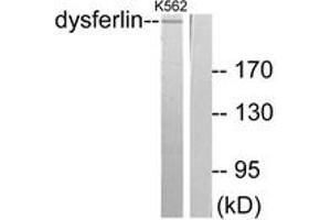 Western blot analysis of extracts from K562 cells, using Dysferlin Antibody. (Dysferlin antibody  (AA 1981-2030))