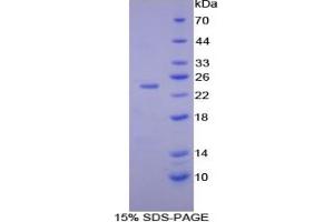 Mouse Detection antibody from the kit in WB with Positive Control: Human lymphocyte lysates. (IL-10 ELISA Kit)