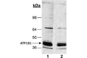 Detection of ATP1B1 in rat kidney homogenates (20 ug) using ATP1B1 monoclonal antibody, clone 464.