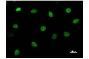 Immunostaining analysis in HeLa cells. (CHD1L antibody)