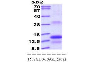 SDS-PAGE (SDS) image for Thyroid Stimulating Hormone, beta (TSHB) (AA 21-138) protein (His tag) (ABIN6387330)