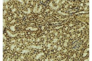 ABIN6277119 at 1/100 staining Mouse kidney tissue by IHC-P.