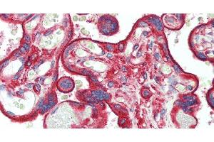 Immunohistochemistry of paraffin-embedded Placenta tissue using CLTC Polyclonal Antibody at dilution of 1:60. (Clathrin Heavy Chain (CLTC) antibody)