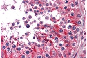 Human Testis: Formalin-Fixed, Paraffin-Embedded (FFPE) (RRAS2 antibody  (AA 1-205))