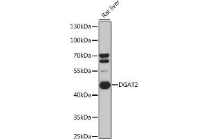 Western blot analysis of extracts of Rat liver cells, using DG antibody (ABIN6130268, ABIN6139559, ABIN6139561 and ABIN6218054) at 1:3000 dilution. (DGAT2 antibody  (AA 113-388))