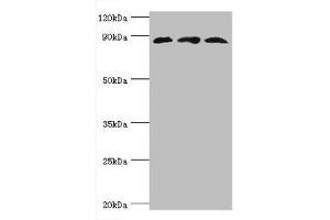 Western blot All lanes: Cullin-1 antibody at 6 μg/mL Lane 1: PC-3 whole cell lysate Lane 2: K562 whole cell lysate Lane 3: Hela whole cell lysate Secondary Goat polyclonal to rabbit IgG at 1/10000 dilution Predicted band size: 90 kDa Observed band size: 90 kDa (Cullin 1 antibody  (AA 500-776))