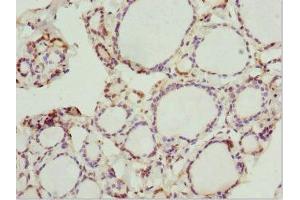 Immunohistochemistry of paraffin-embedded human thyroid tissue using ABIN7162928 at dilution of 1:100 (Peripherin antibody  (AA 1-260))