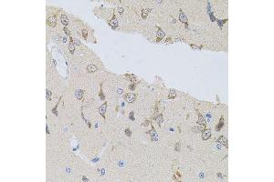 Immunohistochemistry of paraffin-embedded rat brain using NAPA antibody. (NAPA antibody)