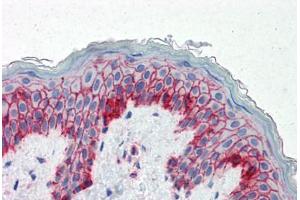 Human Skin (formalin-fixed, paraffin-embedded) stained with B2M antibody ABIN334257 at 5 ug/ml followed by biotinylated anti-mouse IgG secondary antibody ABIN481714, alkaline phosphatase-streptavidin and chromogen. (beta-2 Microglobulin antibody)