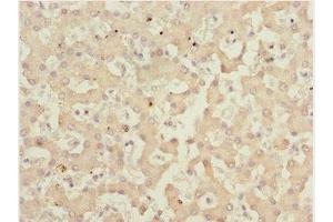 Immunohistochemistry of paraffin-embedded human liver tissue using ABIN7165661 at dilution of 1:100 (IWS1 antibody  (AA 570-819))