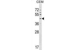 Western Blotting (WB) image for anti-G Protein-Coupled Receptor 63 (GPR63) antibody (ABIN2999284) (GPR63 antibody)