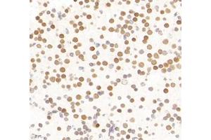 Immunohistochemistry of paraffin embedded mouse neonatal mouse',s brain using LDOCL (ABIN7075411) at dilution of 1:1400 (400x lens) (Retrotransposon Gag-Like Protein 6 (RTL6) antibody)